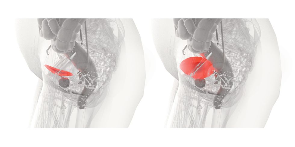 Urine Charge! EV vs. Bladder Is a Whole New Kind of Range Anxiety